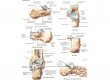 Пяточная кость (calcaneus)