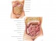 Большой сальник и органы брюшной полости