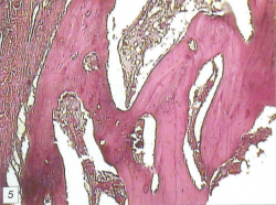 Остеоматрикс - относительно зрелая компактизированная костная ткань