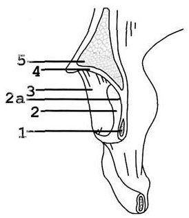 Задняя часть фронтального распила вертлужной впадины